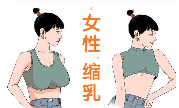缩胸手术危害大吗？ 影响哺乳吗？