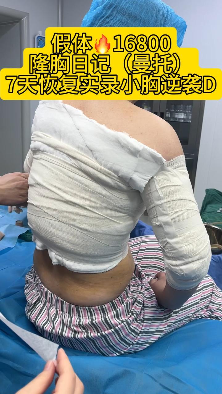 上海曼托隆胸价格一般多少钱？曼托假体隆胸手术费用