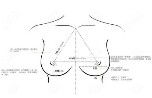 北京假体隆胸价格多少钱？假体隆胸手术费用及注意事项