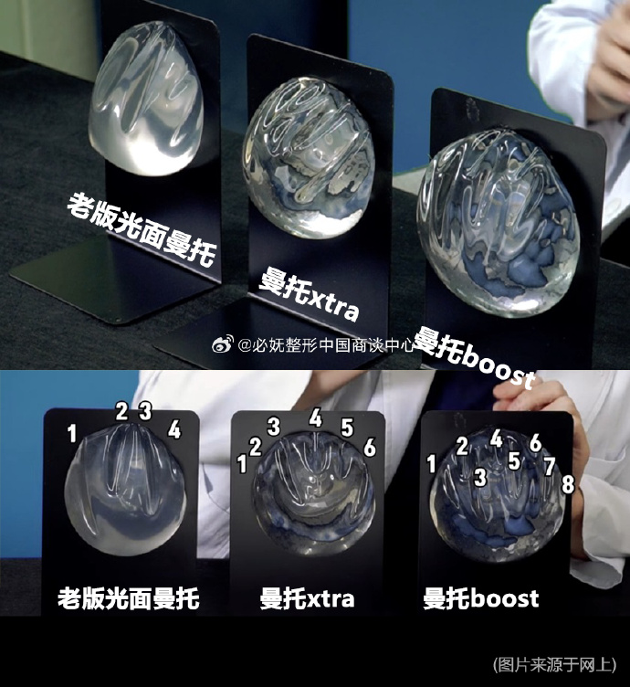傲诺拉和曼托的区别在哪里？隆胸对身体有伤害吗？