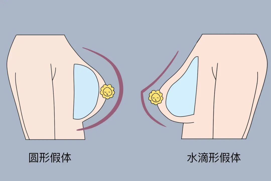 假体隆胸对身体有什么危害吗？假体隆胸会留疤吗？