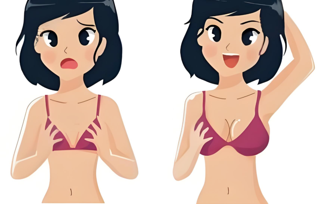 脂肪隆胸存活率多少？脂肪隆胸怎么提高存活率？