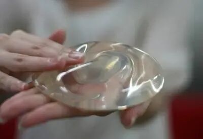 傲诺拉和曼托假体有什么区别？多少钱？