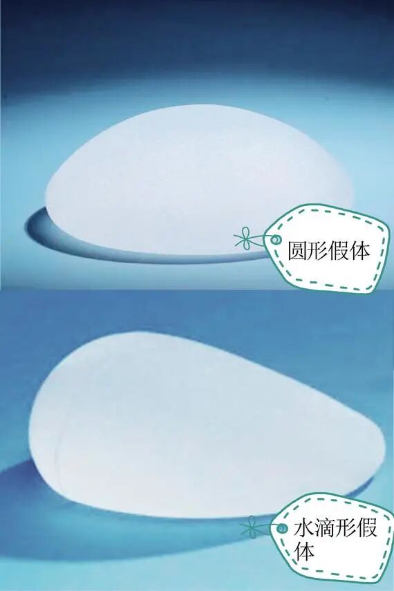 曼托假体隆胸多久变软？曼托隆胸有后遗症吗？