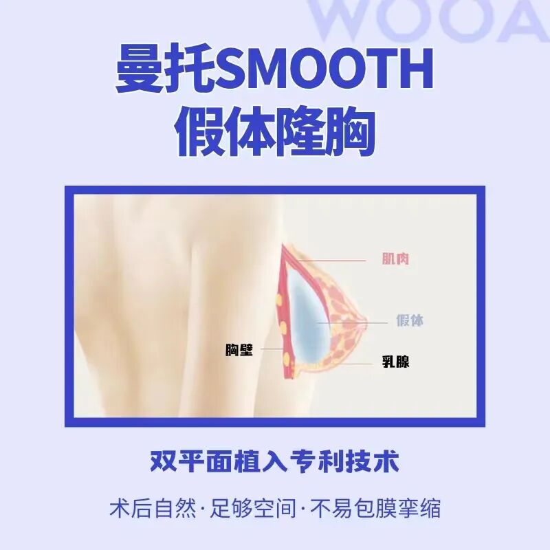 杭州曼托隆胸价格多少钱？杭州曼托品牌隆胸手术费用及效果