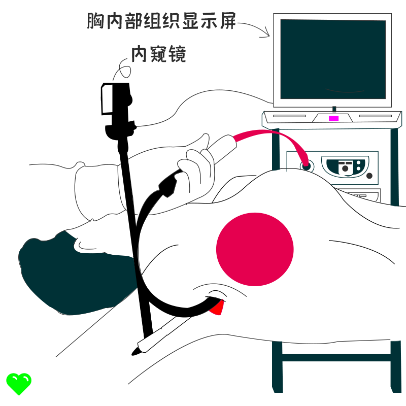 隆胸的方法有哪些？隆胸材料安全吗？