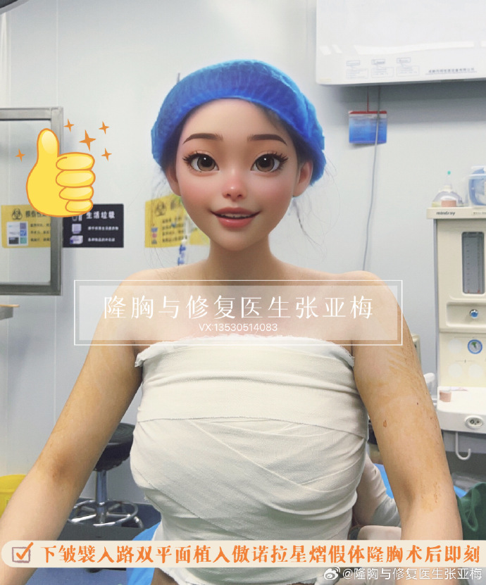 深圳假体隆胸价格多少钱？如何选择合适的医院和医生？